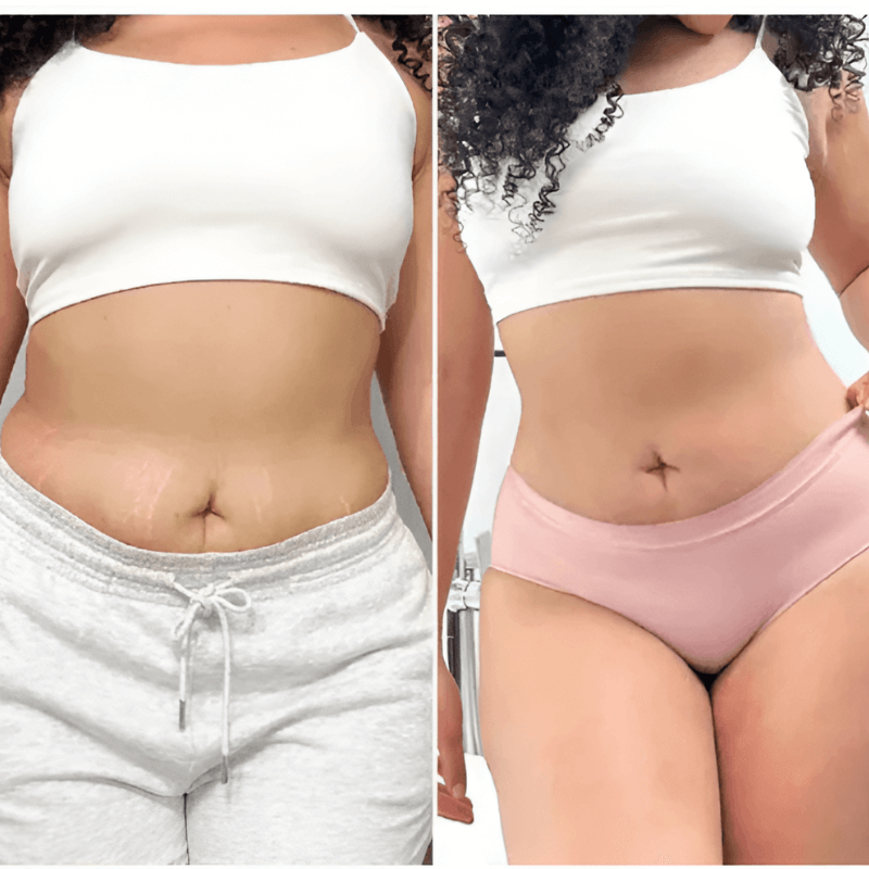 Glamcare™ Anti Cellulite Massager