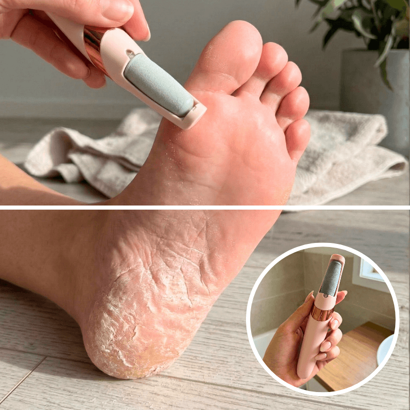 SmoothFeet™ Pro – Glamcare