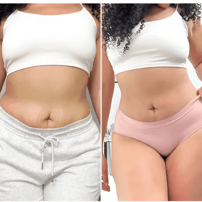 Glamcare™ Anti Cellulite Massager