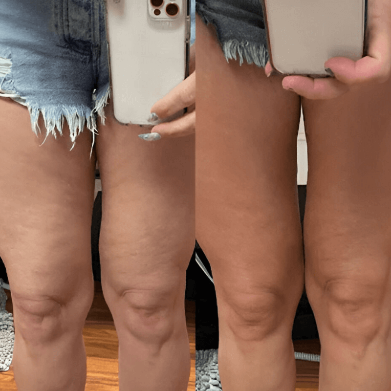 Glamcare™ FirmSkin Pro